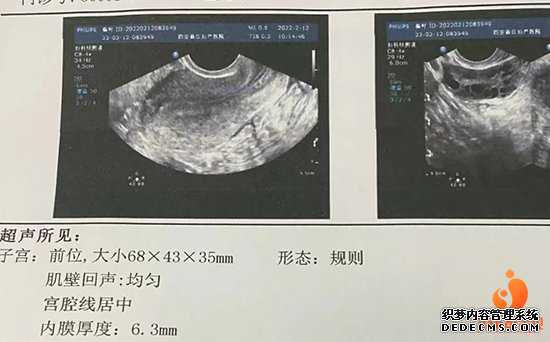 杭州捐卵机构医院,泰国试管助孕机构靠谱吗