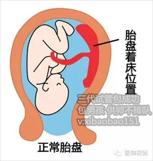 杭州哪里有助孕的,排卵日同房怀男孩一次就中的技巧有哪些？