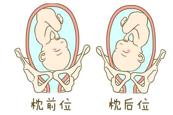 杭州哪里有供卵群,胎位臀位是什么意思？胎位臀位能顺产吗？