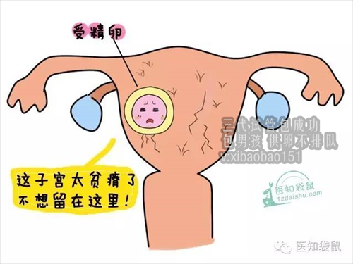 杭州个人找捐卵者,输卵管妊娠，就慎重对待！