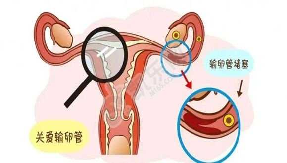 杭州供卵机构电话,昆明爱维艾夫医院试管婴儿流程一览