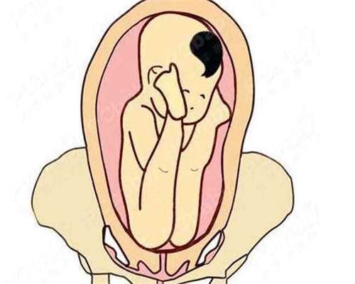 50岁供卵试管需要多少钱_高龄女性_长沙费用透明详解