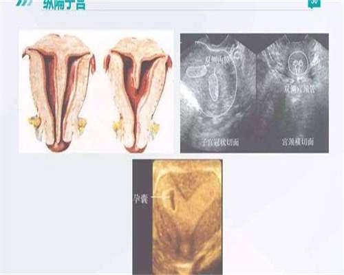 PGD性别筛查成功率_特殊需求人群必看_长沙专业指南