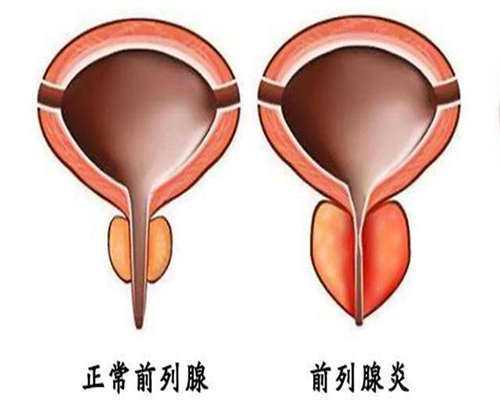 长沙试管检查费用清单